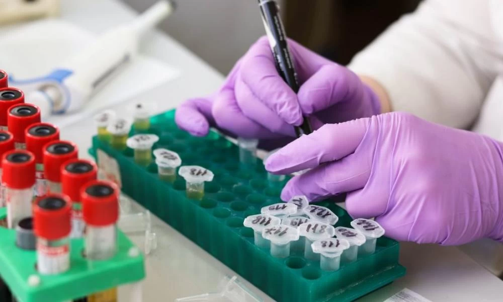 Ρεμντεσιβίρη: Μέχρι τέλη Μαΐου τα σαφή αποτελέσματα λέει ο καθηγητής Γώγος